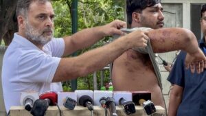 Rahul shows pellet gun injuries of protester to slam Centre, says ‘stop assaulting our students’