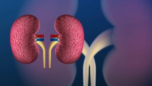Nearly half of 844 million chronic kidney disease cases remain undiagnosed worldwide: Lancet