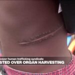Shady surgeons and Nigeria organ harvesting