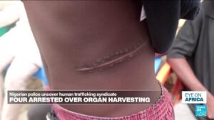 Shady surgeons and Nigeria organ harvesting