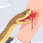 Class 5 student bitten by snake on school premises in Keralam’s Kozhikode