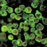 ICMR study identifies well water as major risk factor for amoebic meningoencephalitis in Keralam