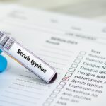 What is scrub typhus | Explained