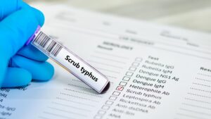 What is scrub typhus | Explained